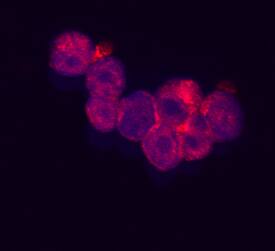 Immunocytochemistry RARRES3 Antibody