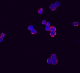 RARRES3 was detected in immersion fixed Raji human Burkitt's lymphoma cell line using Mouse Anti-Human RARRES3 Monoclonal Antibody (Catalog # MAB6139) at 10 µg/mL for 3 hours at room temperature. Cells were stained using the NorthernLights™ 557-conjugated Anti-Mouse IgG Secondary Antibody (red; Catalog # NL007) and counterstained with DAPI (blue). Specific staining was localized to cell surfaces and cytoplasm. View our protocol for Fluorescent ICC Staining of Non-adherent Cells.