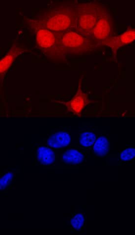 RB1 was detected in immersion fixed MCF-7 human breast cancer cell line using Human RB1 Monoclonal Antibody (Catalog # MAB6495) at 10 µg/mL for 3 hours at room temperature. Cells were stained using the NorthernLights™ 557-conjugated Anti-Mouse IgG Secondary Antibody (red, upper panel; Catalog # NL007) and counterstained with DAPI (blue, lower panel). Specific staining was localized to nuclei. View our protocol for Fluorescent ICC Staining of Cells on Coverslips.