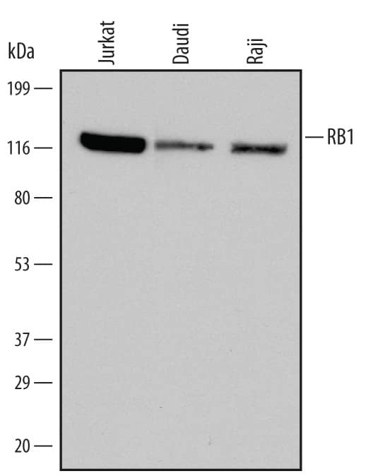 Western Blot RB1 Antibody (607121) [Unconjugated]