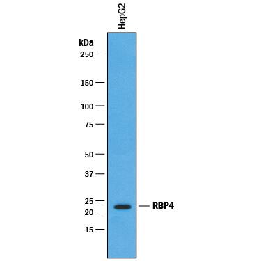 Western blot shows lysates of HepG2 human hepatocellular carcinoma cell line. PVDF membrane was probed with 1 µg/mL of Goat Anti-Human RBP4/Retinol-Binding Protein 4 Antigen Affinity-purified Polyclonal Antibody (Catalog # AF3378) followed by HRP-conjugated Anti-Goat IgG Secondary Antibody (Catalog # HAF019). A specific band was detected for RBP4/Retinol-Binding Protein 4 at approximately 23 kDa (as indicated). This experiment was conducted under reducing conditions and using Immunoblot Buffer Group 1.