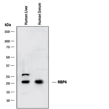 Western blot shows lysates of human liver tissue and human serum. PVDF membrane was probed with 0.05 µg/mL of Rat Anti-Human/Mouse RBP4/Retinol-Binding Protein 4 Monoclonal Antibody (Catalog # MAB34761) followed by HRP-conjugated Anti-Rat IgG Secondary Antibody (HAF005). A specific band was detected for RBP4/Retinol-Binding Protein 4 at approximately 22 kDa (as indicated). This experiment was conducted under reducing conditions and using Immunoblot Buffer Group 1.