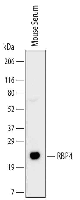 Western blot shows lysates of mouse serum. PVDF Membrane was probed with 2 µg/mL of Rat Anti-Human/Mouse RBP4/Retinol-Binding Protein 4 Monoclonal Antibody (Catalog # MAB34761) followed by HRP-conjugated Anti-Rat IgG Secondary Antibody (HAF005). A specific band was detected for RBP4/Retinol-Binding Protein 4 at approximately 22 kDa (as indicated). This experiment was conducted under reducing conditions and using Immunoblot Buffer Group 1.