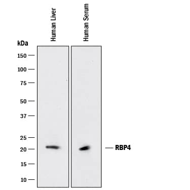 Western blot shows lysates of human liver tissue, and human serum. PVDF membrane was probed with 0.1 µg/mL of Rat Anti-Human/Mouse RBP4/Retinol-Binding Protein 4 Monoclonal Antibody (Catalog # MAB34762) followed by HRP-conjugated Anti-Rat IgG Secondary Antibody (Catalog # HAF005). A specific band was detected for RBP4/Retinol-Binding Protein 4 at approximately 22 kDa (as indicated). This experiment was conducted under reducing conditions and using Immunoblot Buffer Group 1.