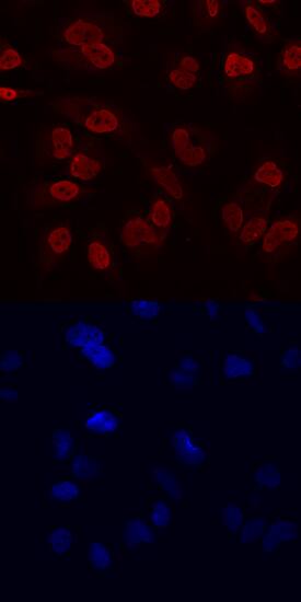 RCOR1/CoREST was detected in immersion fixed HeLa human cervical epithelial carcinoma cell line using Human RCOR1/CoREST Monoclonal Antibody (Catalog # MAB6047) at 10 µg/mL for 3 hours at room temperature. Cells were stained using the NorthernLights™ 557-conjugated Anti-Mouse IgG Secondary Antibody (red, upper panel; Catalog # NL007) and counterstained with DAPI (blue, lower panel). Specific staining was localized to nuclei. View our protocol for Fluorescent ICC Staining of Cells on Coverslips.