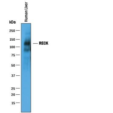 Western Blot RECK Antibody [Unconjugated]