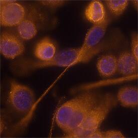 FIZZ1/RELMa was detected in immersion fixed BV-2 mouse microglia cell line using Rat Anti-Mouse FIZZ1/RELMa Monoclonal Antibody (Catalog # MAB1523) at 25 µg/mL for 3 hours at room temperature. Cells were stained using the NorthernLights™ 557-conjugated Anti-Rat IgG Secondary Antibody (orange; Catalog # NL013) and counterstained with DAPI (blue). Specific staining was localized to cytoplasm. View our protocol for Fluorescent ICC Staining of Cells on Coverslips.