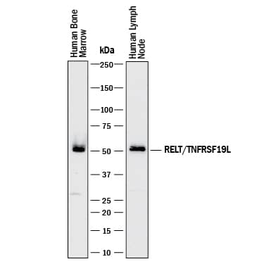 Western Blot RELT/TNFRSF19L Antibody [Unconjugated]