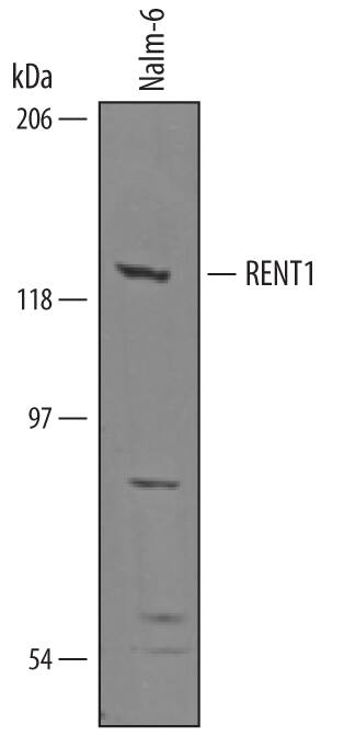 Western blot shows lysates of Nalm-6 human Pre-B acute lymphocytic leukemia cell line. PVDF membrane was probed with 1 µg/mL of Goat Anti-Human RENT1/UPF1 Antigen Affinity-purified Polyclonal Antibody (Catalog # AF5879) followed by HRP-conjugated Anti-Goat IgG Secondary Antibody (Catalog # HAF019). A specific band was detected for RENT1/UPF1 at approximately 125-130 kDa (as indicated). This experiment was conducted under reducing conditions and using Immunoblot Buffer Group 8.