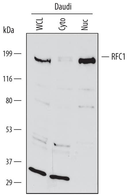 Western Blot RFC1 Antibody [Unconjugated]