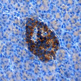 Immunohistochemistry RFX6 Antibody