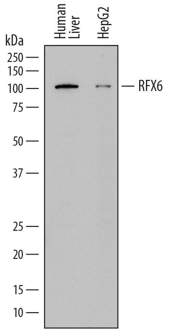 Western blot shows lysates of human liver tissue and HepG2 human hepatocellular carcinoma cell line. PVDF membrane was probed with 2 µg/mL of Mouse Anti-Human RFX6 Monoclonal Antibody (Catalog # MAB7780) followed by HRP-conjugated Anti-Mouse IgG Secondary Antibody (Catalog # HAF018). A specific band was detected for RFX6 at approximately 105 kDa (as indicated). This experiment was conducted under reducing conditions and using Immunoblot Buffer Group 1.