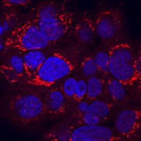 RGM-C/Hemojuvelin was detected in immersion fixed HepG2 human hepatocellular carcinoma cell line using Goat Anti-Human/Mouse RGM-C/Hemojuvelin Antigen Affinity-purified Polyclonal Antibody (Catalog # AF3720) at 10 µg/mL for 3 hours at room temperature. Cells were stained using the NorthernLights™ 557-conjugated Anti-Goat IgG Secondary Antibody (red; Catalog # NL001) and counterstained with DAPI (blue). Specific staining was localized to cytoplasm. View our protocol for Fluorescent ICC Staining of Cells on Coverslips.