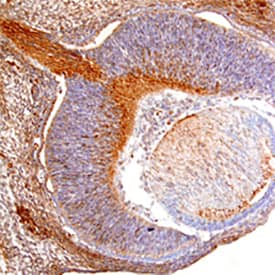 RGM-A was detected in immersion fixed frozen sections of mouse embryo (13 d.p.c) using Goat Anti-Mouse RGM-A Antigen Affinity-purified Polyclonal Antibody (Catalog # AF2458) at 15 µg/mL overnight at 4 °C. Tissue was stained using the Anti-Goat HRP-DAB Cell & Tissue Staining Kit (brown; Catalog # CTS008) and counterstained with hematoxylin (blue). Specific staining was localized to retina and developing neurons in cross-section of the developing eye. View our protocol for Chromogenic IHC Staining of Frozen Tissue Sections.
