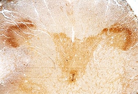 Immunohistochemistry RGM-A Antibody [Unconjugated]