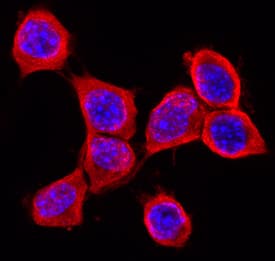 RGM-B was detected in immersion fixed Neuro-2A mouse neuroblastoma cell line using Sheep Anti-Mouse RGM-B Biotinylated Antigen Affinity-purified Polyclonal Antibody (Catalog # BAF3597) at 10 µg/mL for 3 hours at room temperature. Cells were stained using the NorthernLights™ 557-conjugated Streptavidin (red; Catalog # NL999) and counterstained with DAPI (blue). Specific staining was localized to cell surfaces. View our protocol for Fluorescent ICC Staining of Cells on Coverslips.