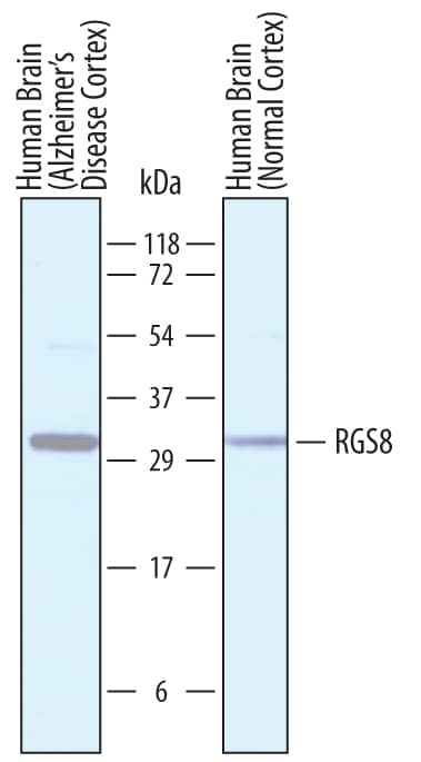 Western Blot RGS8 Antibody