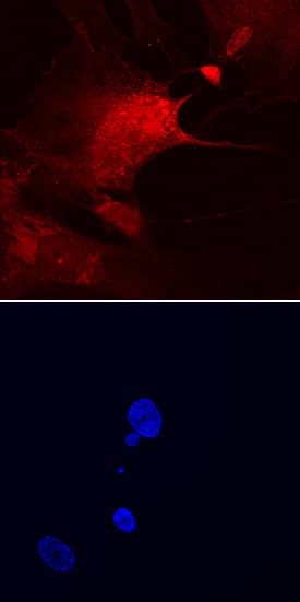 RIAM/APBB1IP was detected in immersion fixed Wi-38 human lung fibroblast cell line using Sheep Anti-Human RIAM/APBB1IP Antigen Affinity-purified Polyclonal Antibody (Catalog # AF7279) at 10 µg/mL for 3 hours at room temperature. Cells were stained using the NorthernLights™ 557-conjugated Anti-Sheep IgG Secondary Antibody (red, upper panel; Catalog # NL010) and counterstained with DAPI (blue, lower panel). Specific staining was localized to cytoplasm. View our protocol for Fluorescent ICC Staining of Cells on Coverslips.