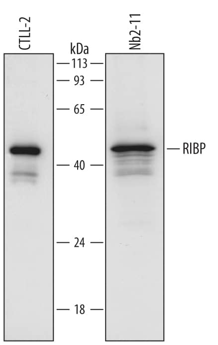 Western blot shows lysates of CTLL-2 mouse cytotoxic T cell line and Nb2-11 rat lymphoma cell line. PVDF Membrane was probed with 1 µg/mL of Sheep Anti-Mouse/Rat RIBP/SH2D2A Antigen Affinity-purified Polyclonal Antibody (Catalog # AF6265) followed by HRP-conjugated Anti-Sheep IgG Secondary Antibody (Catalog # HAF016). A specific band was detected for RIBP/SH2D2A at approximately 46 kDa (as indicated). This experiment was conducted under reducing conditions and using Immunoblot Buffer Group 1.