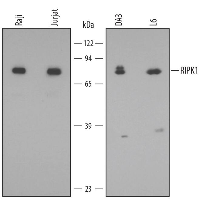 Western blot shows lysates of Raji human Burkitt's lymphoma cell line, Jurkat human acute T cell leukemia cell line, DA3 mouse myeloma cell line, and L6 rat myoblast cell line. PVDF membrane was probed with 0.5 µg/mL of Mouse Anti-Human/Mouse/Rat RIPK1/RIP1 Monoclonal Antibody (Catalog # MAB3585) followed by HRP-conjugated Anti-Mouse IgG Secondary Antibody (Catalog # HAF007). A specific band was detected for RIPK1/RIP1 at approximately 75 kDa (as indicated). This experiment was conducted under reducing conditions and using Immunoblot Buffer Group 2.