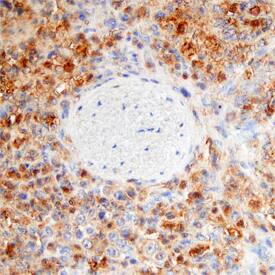 RIPK3/RIP3 was detected in immersion fixed paraffin-embedded sections of human spleen using Mouse Anti-Human RIPK3/RIP3 Monoclonal Antibody (Catalog # MAB7604) at 15 µg/mL overnight at 4 °C. Tissue was stained using the Anti-Mouse HRP-DAB Cell & Tissue Staining Kit (brown; Catalog # CTS002) and counterstained with hematoxylin (blue). Specific staining was localized to the cytoplasm of splenocytes. View our protocol for Chromogenic IHC Staining of Paraffin-embedded Tissue Sections.