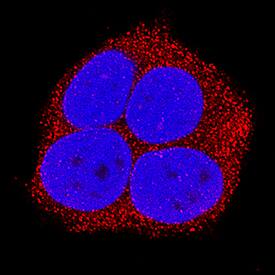 RIPK1/RIP1 was detected in immersion fixed MCF-7 human breast cancer cell line using Mouse Anti-Human/Mouse/Rat RIPK1/RIP1 Monoclonal Antibody (Catalog # MAB3585) at 25 µg/mL for 3 hours at room temperature. Cells were stained using the NorthernLights™ 557-conjugated Anti-Mouse IgG Secondary Antibody (red; Catalog # NL007) and counterstained with DAPI (blue). Specific staining was localized to cytoplasm. View our protocol for Fluorescent ICC Staining of Cells on Coverslips.
