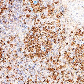 RIPK2/RIP2 was detected in immersion fixed paraffin-embedded sections of human tonsil using Mouse Anti-Human RIPK2/RIP2 Monoclonal Antibody (Catalog # MAB103871) at 5 µg/mL for 1 hour at room temperature followed by incubation with the Anti-Mouse IgG VisUCyte™ HRP Polymer Antibody (Catalog # VC001). Before incubation with the primary antibody, tissue was subjected to heat-induced epitope retrieval using Antigen Retrieval Reagent-Basic (Catalog # CTS013). Tissue was stained using DAB (brown) and counterstained with hematoxylin (blue). Specific staining was localized to lymphocytes. View our protocol for IHC Staining with VisUCyte HRP Polymer Detection Reagents.