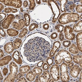 RIPK4/RIP4 was detected in immersion fixed paraffin-embedded sections of human kidney using Goat Anti-Human/Mouse RIPK4/RIP4 Antigen Affinity-purified Polyclonal Antibody (Catalog # AF10002) at 0.3 µg/mL for 1 hour at room temperature followed by incubation with the Anti-Goat IgG VisUCyte&amp;#8482; HRP Polymer Antibody (Catalog # &lt;a class=NoLineLink href=