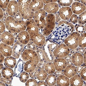 RIPK4/RIP4 was detected in perfusion fixed frozen sections of mouse kidney using Goat Anti-Human/Mouse RIPK4/RIP4 Antigen Affinity-purified Polyclonal Antibody (Catalog # AF10002) at 1 µg/mL for 1 hour at room temperature followed by incubation with the Anti-Goat IgG VisUCyte™ HRP Polymer Antibody (Catalog # VC004). Before incubation with the primary antibody, tissue was subjected to heat-induced epitope retrieval using Antigen Retrieval Reagent-Basic (Catalog # CTS013). Tissue was stained using DAB (brown) and counterstained with hematoxylin (blue). Specific staining was localized to cytoplasm in cells in convoluted tubules. View our protocol for IHC Staining with VisUCyte HRP Polymer Detection Reagents.