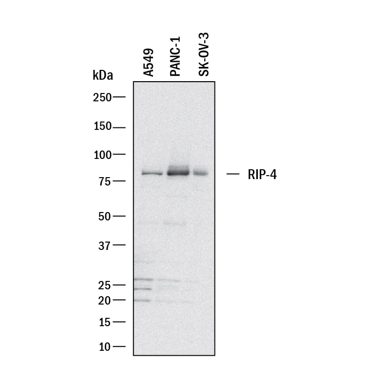 Western blot shows lysates of A549 human lung carcinoma cell line, PANC-1 human pancreatic carcinoma cell line, and SK-OV-3 human ovarian adenocarcinoma cell line. PVDF membrane was probed with 2 µg/mL of Goat Anti-Human/Mouse RIPK4/RIP4 Antigen Affinity-purified Polyclonal Antibody (Catalog # AF10002) followed by HRP-conjugated Anti-Goat IgG Secondary Antibody (Catalog # &lt;a class=