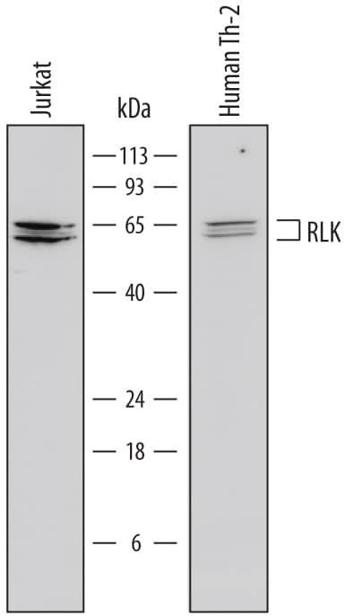 Western Blot RLK/TXK Antibody (674801)