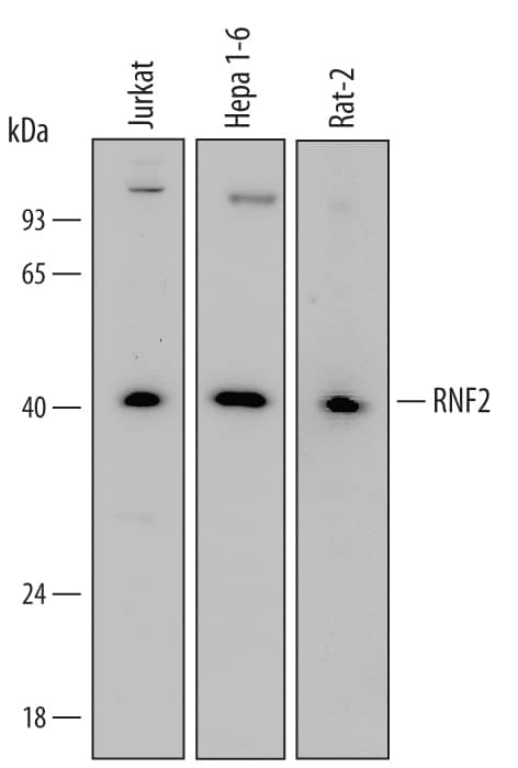 Western blot shows lysates of Jurkat human acute T cell leukemia cell line, Hepa 1-6 mouse hepatoma cell line, and Rat-2 rat embryonic fibroblast cell line. PVDF Membrane was probed with 1 µg/mL of Goat Anti-Human/Mouse/Rat RNF2 Antigen Affinity-purified Polyclonal Antibody (Catalog # AF6065) followed by HRP-conjugated Anti-Goat IgG Secondary Antibody (Catalog # HAF109). A specific band was detected for RNF2 at approximately 40 kDa (as indicated). This experiment was conducted under reducing conditions and using Immunoblot Buffer Group 2.