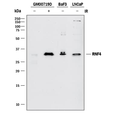 Western Blot RNF4 Antibody [Unconjugated]
