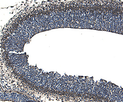 Immunohistochemistry ROBO1 Antibody