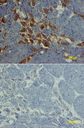 Immunohistochemistry ROBO1 Antibody
