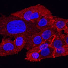ROBO1 was detected in immersion fixed HepG2 human hepatocellular carcinoma cell line using Sheep Anti-Human ROBO1 Antigen Affinity-purified Polyclonal Antibody (Catalog # AF7118) at 10 µg/mL for 3 hours at room temperature. Cells were stained using the NorthernLights™ 557-conjugated Anti-Sheep IgG Secondary Antibody (red; Catalog # NL010) and counterstained with DAPI (blue). Specific staining was localized to cell surfaces and cytoplasm. View our protocol for Fluorescent ICC Staining of Cells on Coverslips.