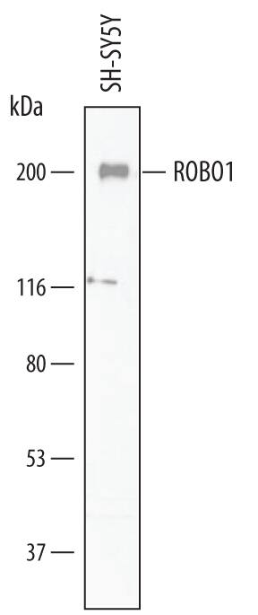 Western blot shows lysates of SH-SY5Y human neuroblastoma cell line. PVDF membrane was probed with 1 µg/mL of Sheep Anti-Human ROBO1 Antigen Affinity-purified Polyclonal Antibody (Catalog # AF7118) followed by HRP-conjugated Anti-Sheep IgG Secondary Antibody (Catalog # HAF016). A specific band was detected for ROBO1 at approximately 200 kDa (as indicated). This experiment was conducted under reducing conditions and using Immunoblot Buffer Group 1.