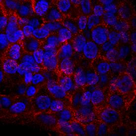 ROBO1 was detected in immersion fixed HepG2 human hepatocellular carcinoma cell line using Mouse Anti-Human ROBO1 Monoclonal Antibody (Catalog # MAB71181) at 10 µg/mL for 3 hours at room temperature. Cells were stained using the NorthernLights™ 557-conjugated Anti-Mouse IgG Secondary Antibody (red; Catalog # NL007) and counterstained with DAPI (blue). Specific staining was localized to cell surfaces and cytoplasm. View our protocol for Fluorescent ICC Staining of Cells on Coverslips.
