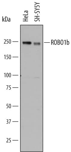 Western blot shows lysates of HeLa human cervical epithelial carcinoma cell line and SH-SY5Y human neuroblastoma cell line. PVDF membrane was probed with 2 µg/mL of Mouse Anti-Human ROBO1 Monoclonal Antibody (Catalog # MAB7118) followed by HRP-conjugated Anti-Mouse IgG Secondary Antibody (Catalog # HAF007). A specific band was detected for ROBO1 at approximately 220 kDa (as indicated). This experiment was conducted under reducing conditions and using Immunoblot Buffer Group 1.
