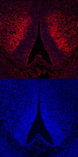 ROBO3 was detected in immersion fixed frozen sections of mouse embryo (E11.5) using Mouse ROBO3 Antigen Affinity-purified Polyclonal Antibody (Catalog # AF3155) at 25 µg/mL overnight at 4 °C. Tissue was stained using the NorthernLights™ 557-conjugated Anti-Goat IgG Secondary Antibody (red, upper panel; Catalog # NL001) and counterstained with DAPI (blue, lower panel). Specific staining was localized to developing forebrain. View our protocol for Fluorescent IHC Staining of Frozen Tissue Sections.