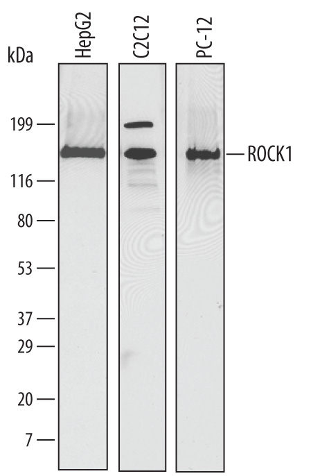 Western blot shows lysates of HepG2 human hepatocellular carcinoma cell line, C2C12 mouse myoblast cell line, and PC-12 rat adrenal pheochromocytoma cell line. PVDF membrane was probed with 2 µg/mL of Mouse Anti-Human ROCK1 Monoclonal Antibody (Catalog # MAB4590) followed by HRP-conjugated Anti-Mouse IgG Secondary Antibody (Catalog # HAF007). A specific band was detected for ROCK1 at approximately 160 kDa (as indicated). This experiment was conducted under reducing conditions and using Immunoblot Buffer Group 1.