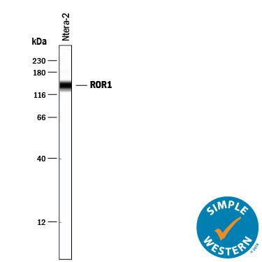 Simple Western ROR1 Antibody [Unconjugated]