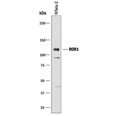 Western Blot ROR1 Antibody [Unconjugated]