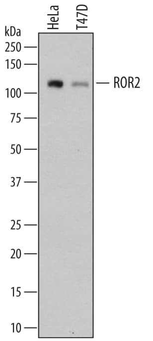Western Blot ROR2 Antibody [Unconjugated]