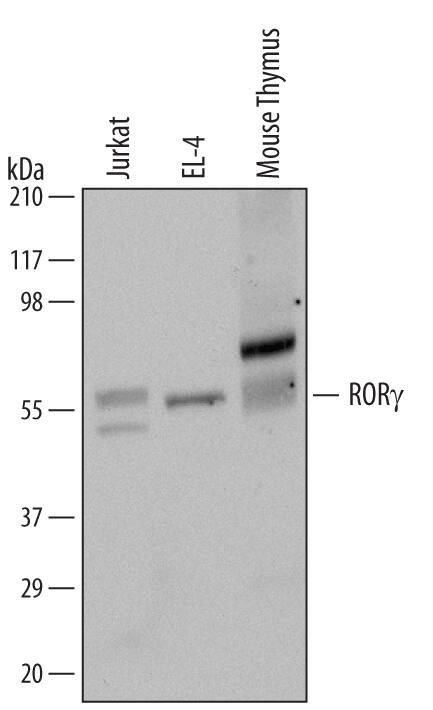 Western blot shows lysates of Jurkat human acute T cell leukemia cell line, EL-4 mouse lymphoblast cell line, and mouse thymus tissue. PVDF Membrane was probed with 0.5 µg/mL of Mouse Anti-Human/Mouse ROR gamma/NR1F3 Monoclonal Antibody (Catalog # MAB6109) followed by HRP-conjugated Anti-Mouse IgG Secondary Antibody (Catalog # HAF007). A specific band was detected for ROR gamma/NR1F3 at approximately 60 kDa (as indicated). This experiment was conducted under reducing conditions and using Immunoblot Buffer Group 1.