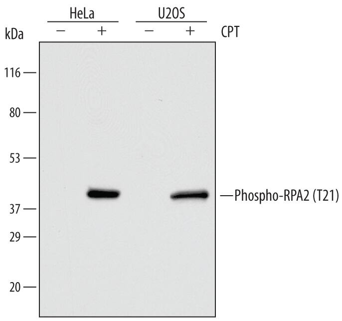Western blot shows lysates of HeLa human cervical epithelial carcinoma cell line and U2OS human osteosarcoma cell line untreated (-) or treated (+) with 1 µM Camptothecin (CPT) for 1 hour. PVDF Membrane was probed with 0.5 µg/mL of Human Phospho-RPA2 (T21) Antigen Affinity-purified Polyclonal Antibody (Catalog # AF6654) followed by HRP-conjugated Anti-Rabbit IgG Secondary Antibody (Catalog # HAF008). A specific band was detected for Phospho-RPA2 (T21) at approximately 40 kDa (as indicated). This experiment was conducted under reducing conditions and using Immunoblot Buffer Group 1.