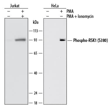 Western Blot RSK1 [p Ser380] Antibody (1024A) [Unconjugated]