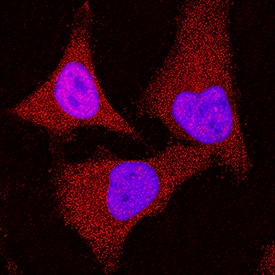 RSK1 was detected in immersion fixed HeLa human cervical epithelial carcinoma cell line using Mouse Anti-Human RSK1 Monoclonal Antibody (Catalog # MAB992) at 8 µg/mL for 3 hours at room temperature. Cells were stained using the NorthernLights™ 557-conjugated Anti-Mouse IgG Secondary Antibody (red; Catalog # NL007) and counterstained with DAPI (blue). Specific staining was localized to cytoplasm and nuclei. View our protocol for Fluorescent ICC Staining of Cells on Coverslips.