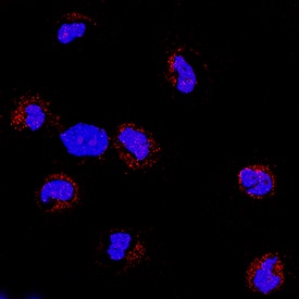 RTTN was detected in immersion fixed HDLM-2 human Hodgkin's lymphoma cell line using Rabbit Anti-Human RTTN Monoclonal Antibody (Catalog # MAB9966) at 8 µg/mL for 3 hours at room temperature. Cells were stained using the NorthernLights™ 557-conjugated Anti-Rabbit IgG Secondary Antibody (red; Catalog # NL004) and counterstained with DAPI (blue). Specific staining was localized to cytoplasm. View our protocol for Fluorescent ICC Staining of Non-adherent Cells.