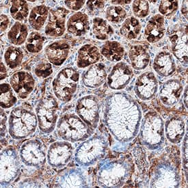 RTTN was detected in immersion fixed paraffin-embedded sections of human stomach using Rabbit Anti-Human RTTN Monoclonal Antibody (Catalog # MAB9966) at 1 µg/mL for 1 hour at room temperature followed by incubation with the Anti-Rabbit IgG VisUCyte™ HRP Polymer Antibody (Catalog # VC003). Tissue was stained using DAB (brown) and counterstained with hematoxylin (blue). Specific staining was localized to cytoplasm in gastric glands. View our protocol for IHC Staining with VisUCyte HRP Polymer Detection Reagents.